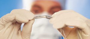 cirujano con implante coclear