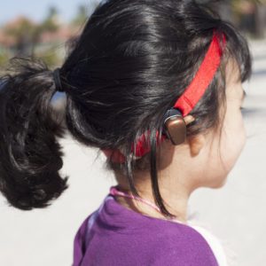 Softband, una opción no quirúrgica de Cochlear
