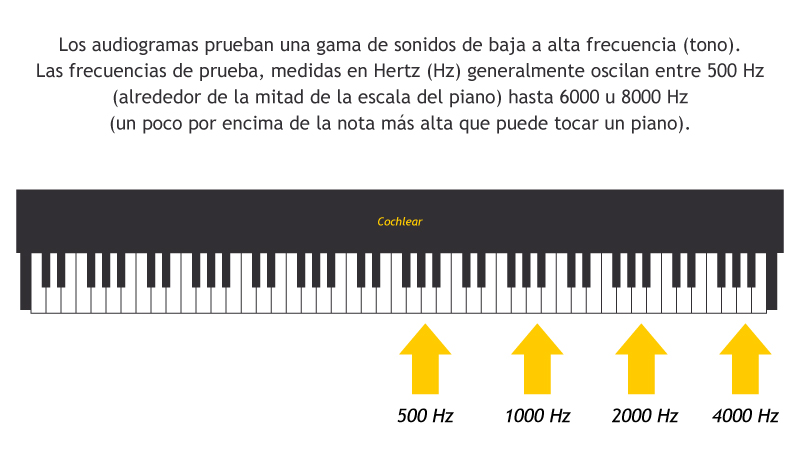 Audiógrama