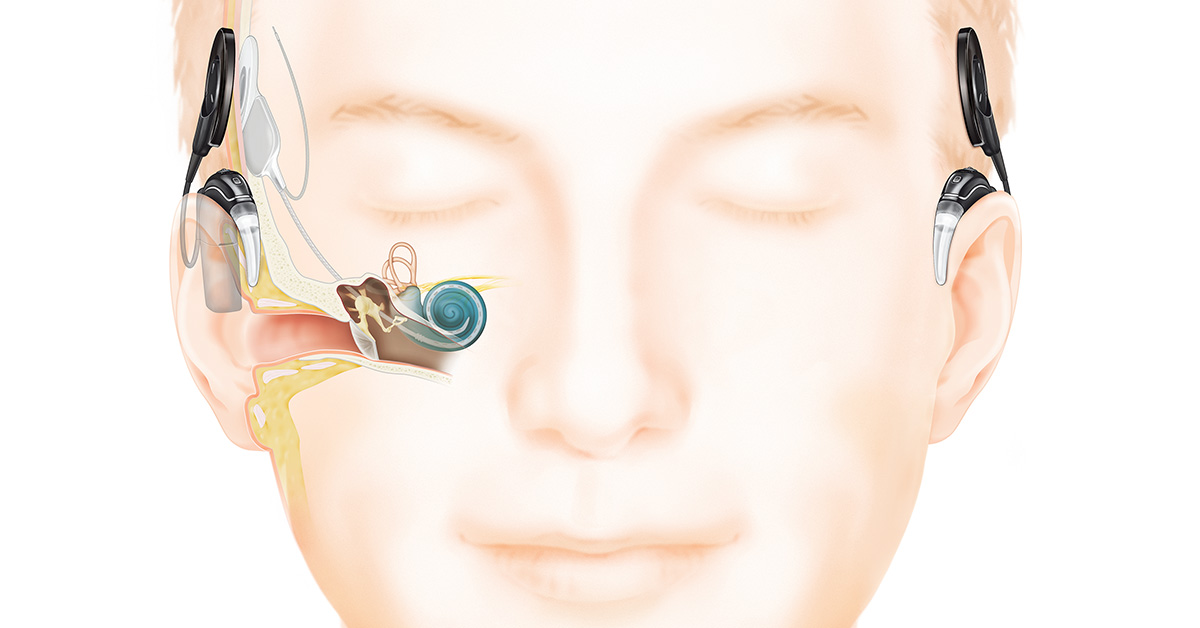 You are currently viewing Audição binaural: vantagens da estimulação auditiva bilateral