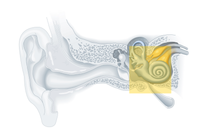 Tipos de tratamento para a perda auditiva 1